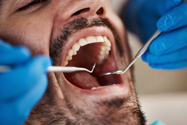 Best Emergency Cosmetic Dentistry (e.g., broken veneers) in Troy, TN